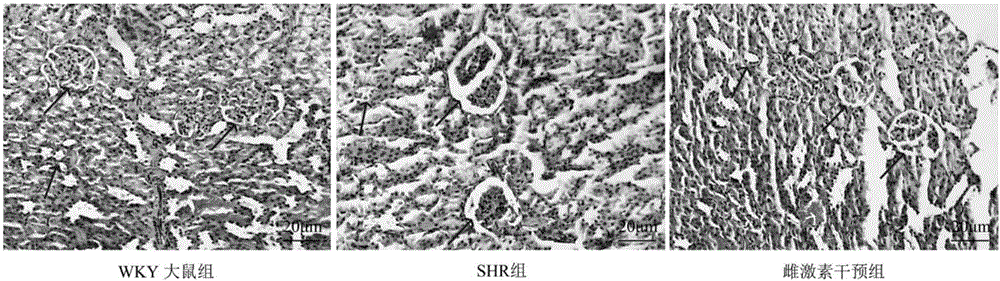 Experimental method for proving connected relation of estrogen and gap