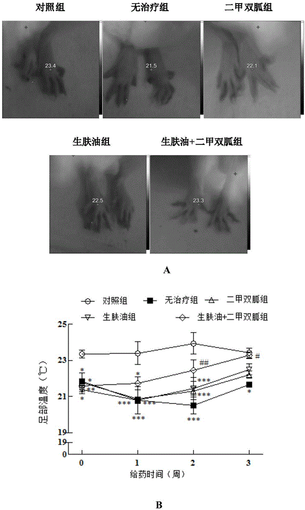 Application of externally used skin generation oil in preparation of drugs for preventing or treating diabetic peripheral circulation disturbance and foot ulcer