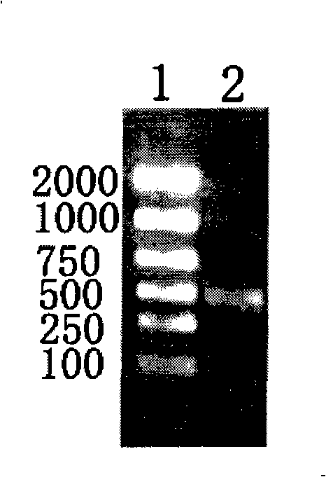 Paragonimiasis detection device and method for making same