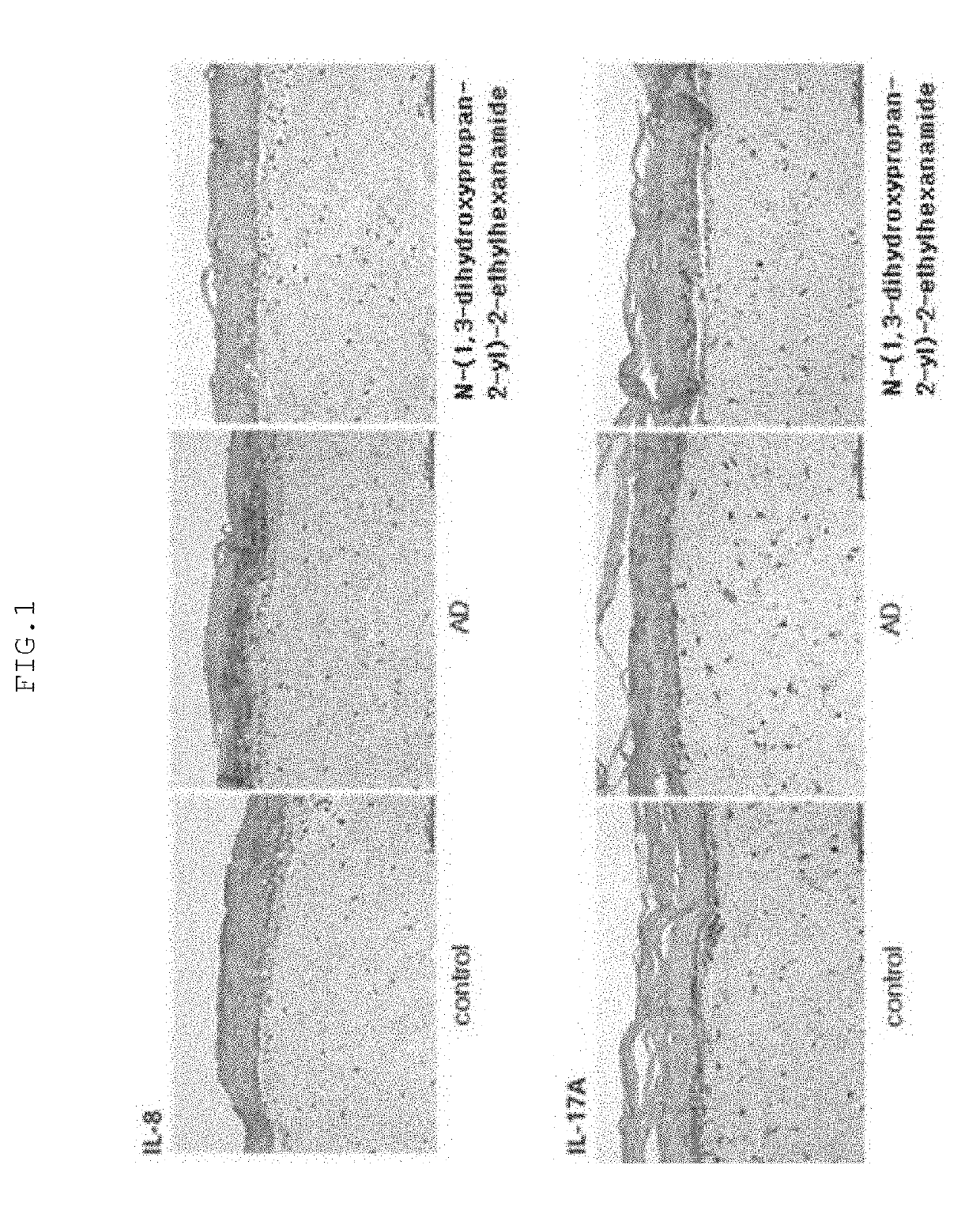 Anti-inflammatory composition