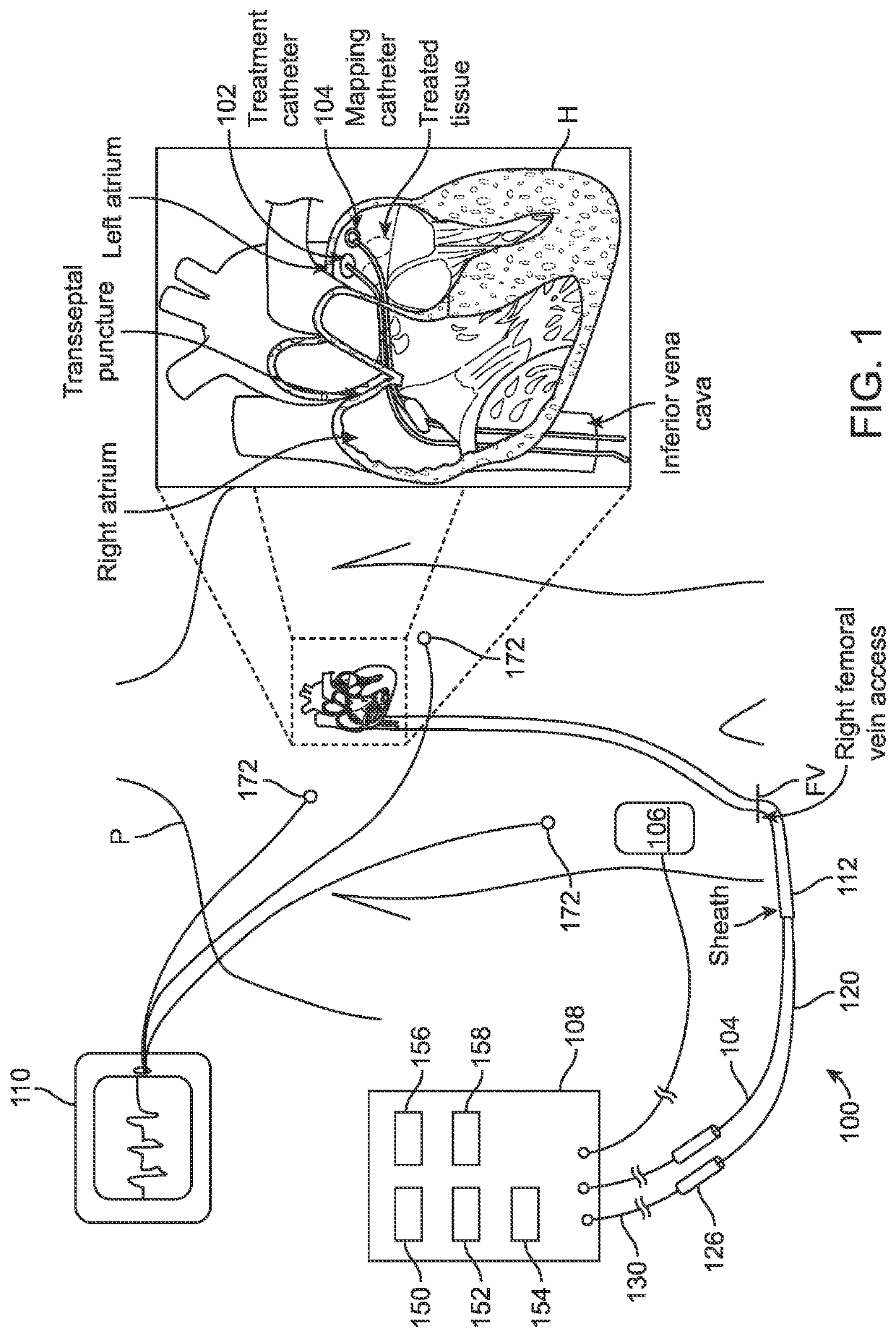 Treatment of cardiac tissue with pulsed electric fields