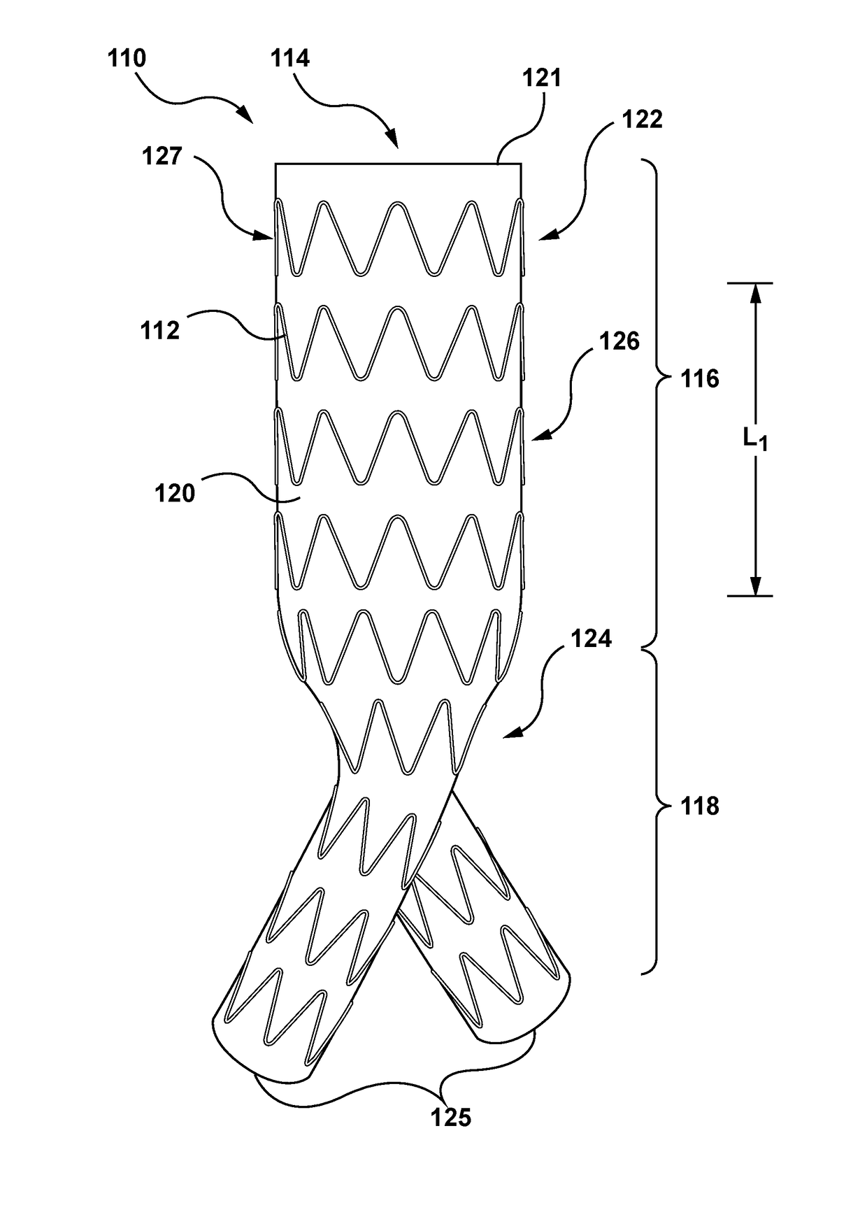 Endoluminal prosthetic assemblies, and associated systems and methods for percutaneous repair of a vascular tissue defect
