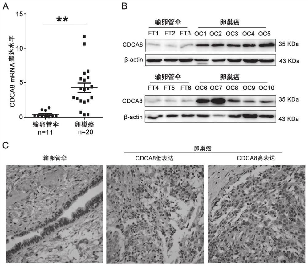 Application of CDCA8 in preparation of drug for treating ovarian cancer