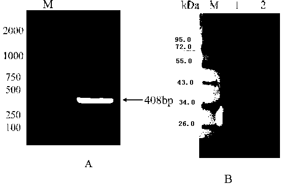 Molecular marker for eimeria tenella sensitive strain and drug-resistant strain and application of molecular marker