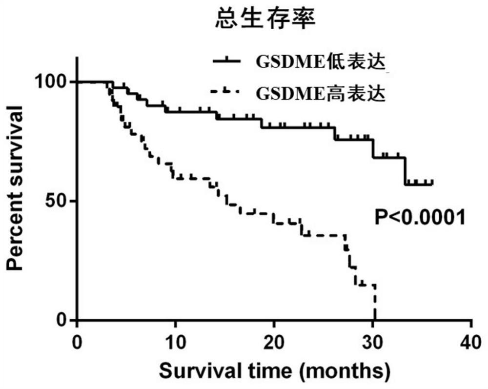 Application of serum GSDME in diagnosis, curative effect monitoring and prognosis evaluation of B lymphocytic leukemia