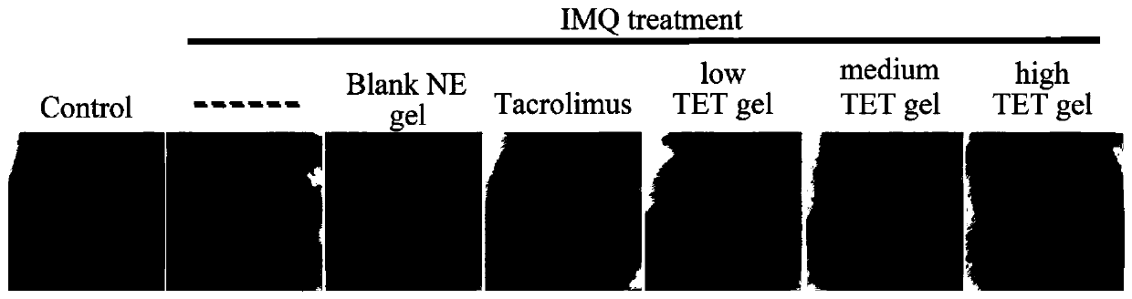 Tetrandrine composition, preparation method of tetrandrine composition, external tetrandrine preparation, and preparation method and application of external tetrandrine preparation