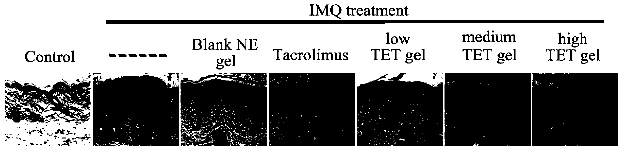 Tetrandrine composition, preparation method of tetrandrine composition, external tetrandrine preparation, and preparation method and application of external tetrandrine preparation