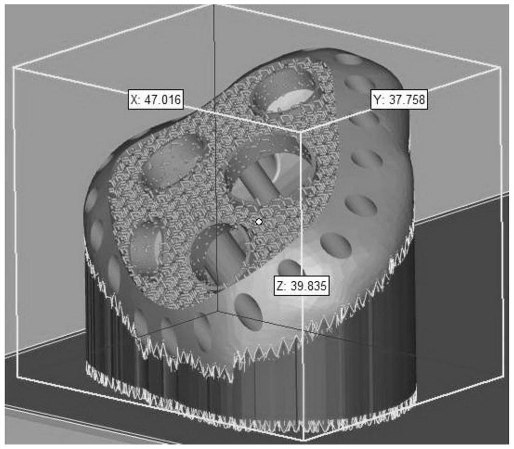 A manufacturing method of laser additive manufacturing-high temperature vacuum sintering porous tantalum bone implant prosthesis with bone-imitation trabecular structure