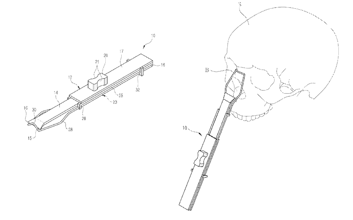 Surgical instrument for removing hook nose bone