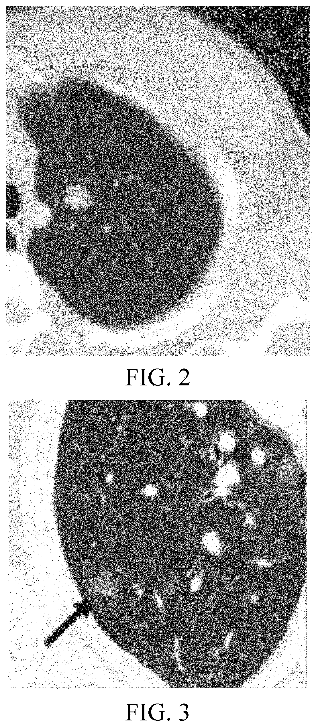 Medical image aided diagnosis method and system combining image recognition and report editing