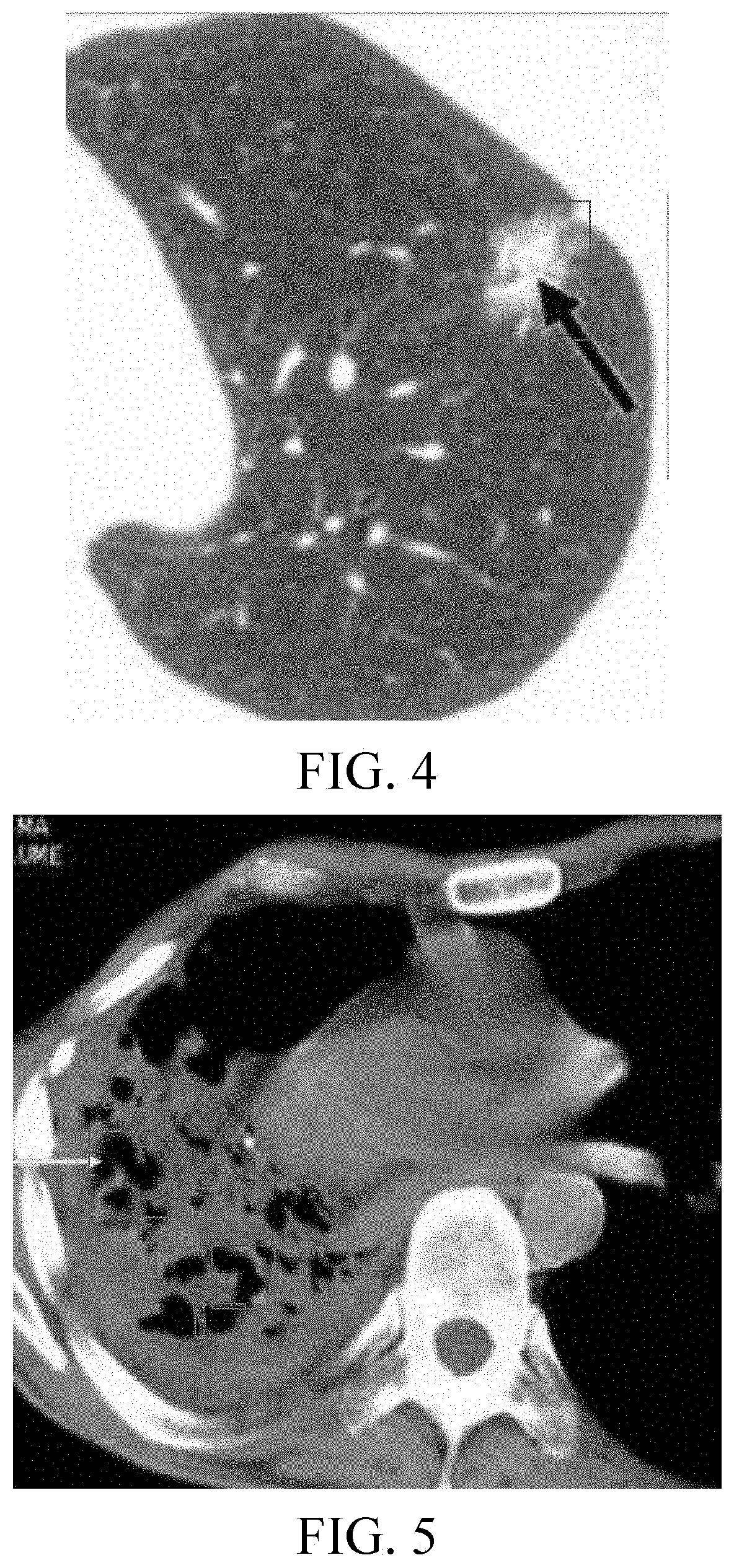 Medical image aided diagnosis method and system combining image recognition and report editing