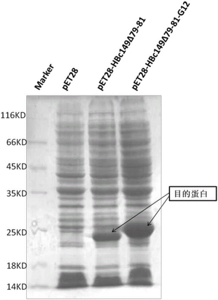 Human Gremlin 1 chimeric vaccine for treating liver fibrosis, and applications thereof