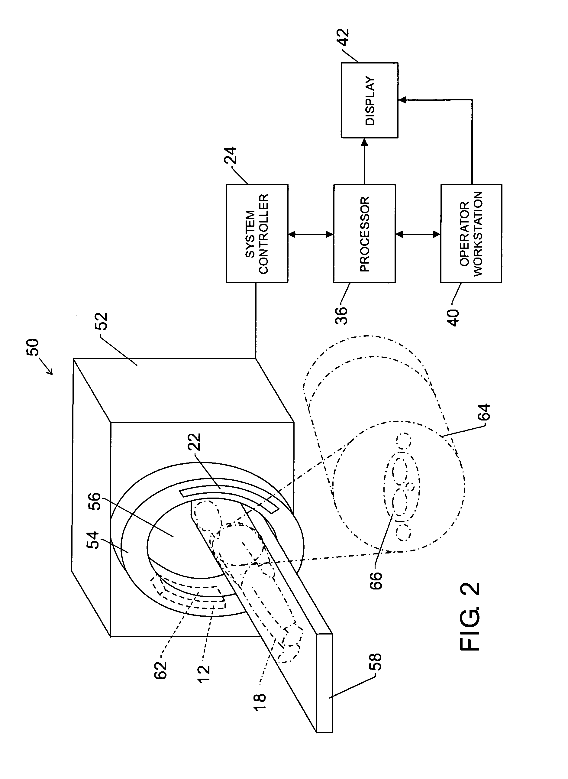 Method and apparatus for reduction of artifacts in computed tomography images