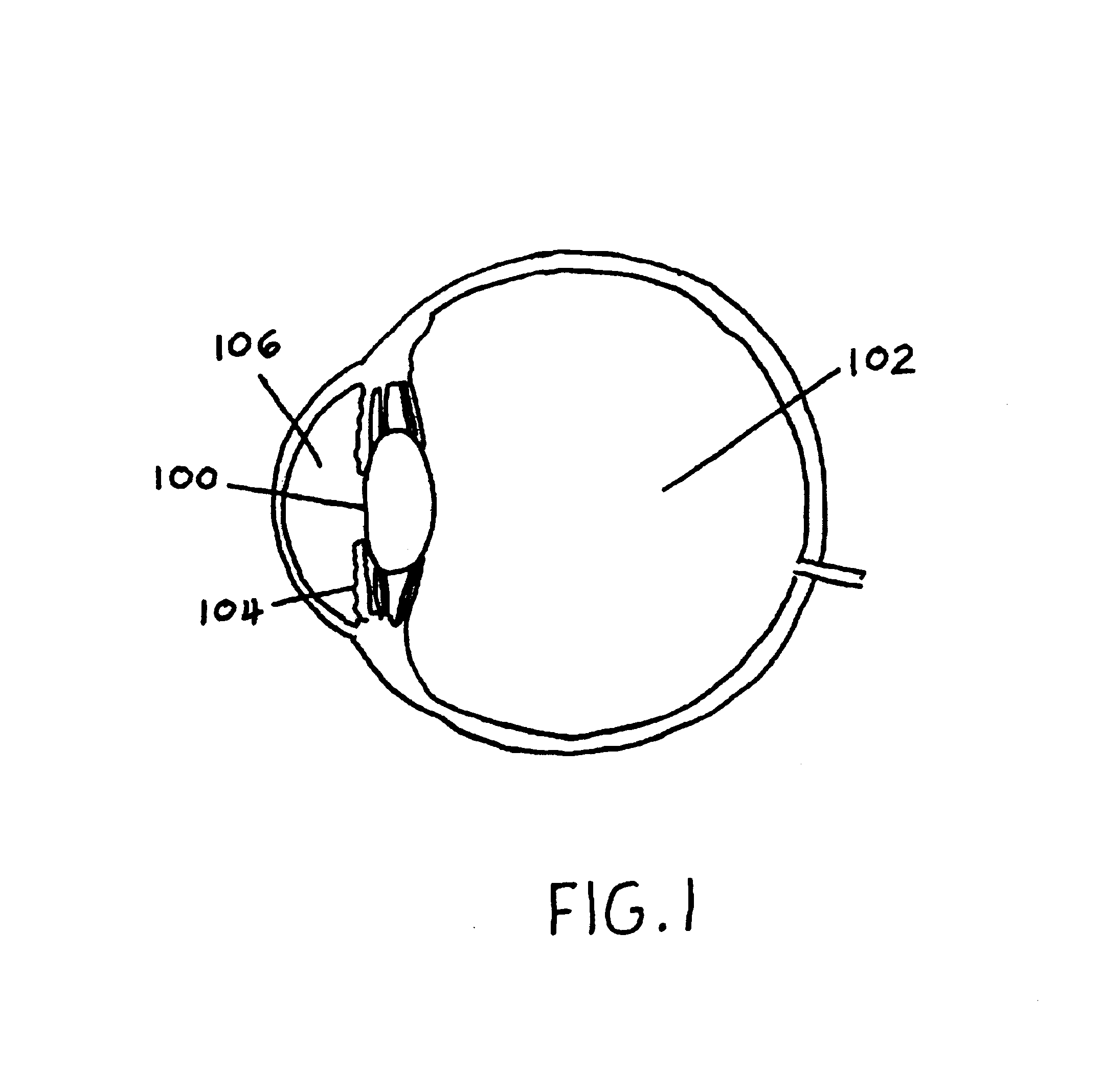 Method and apparatus for the automatic real-time detection and correction of red-eye defects in batches of digital images or in handheld appliances