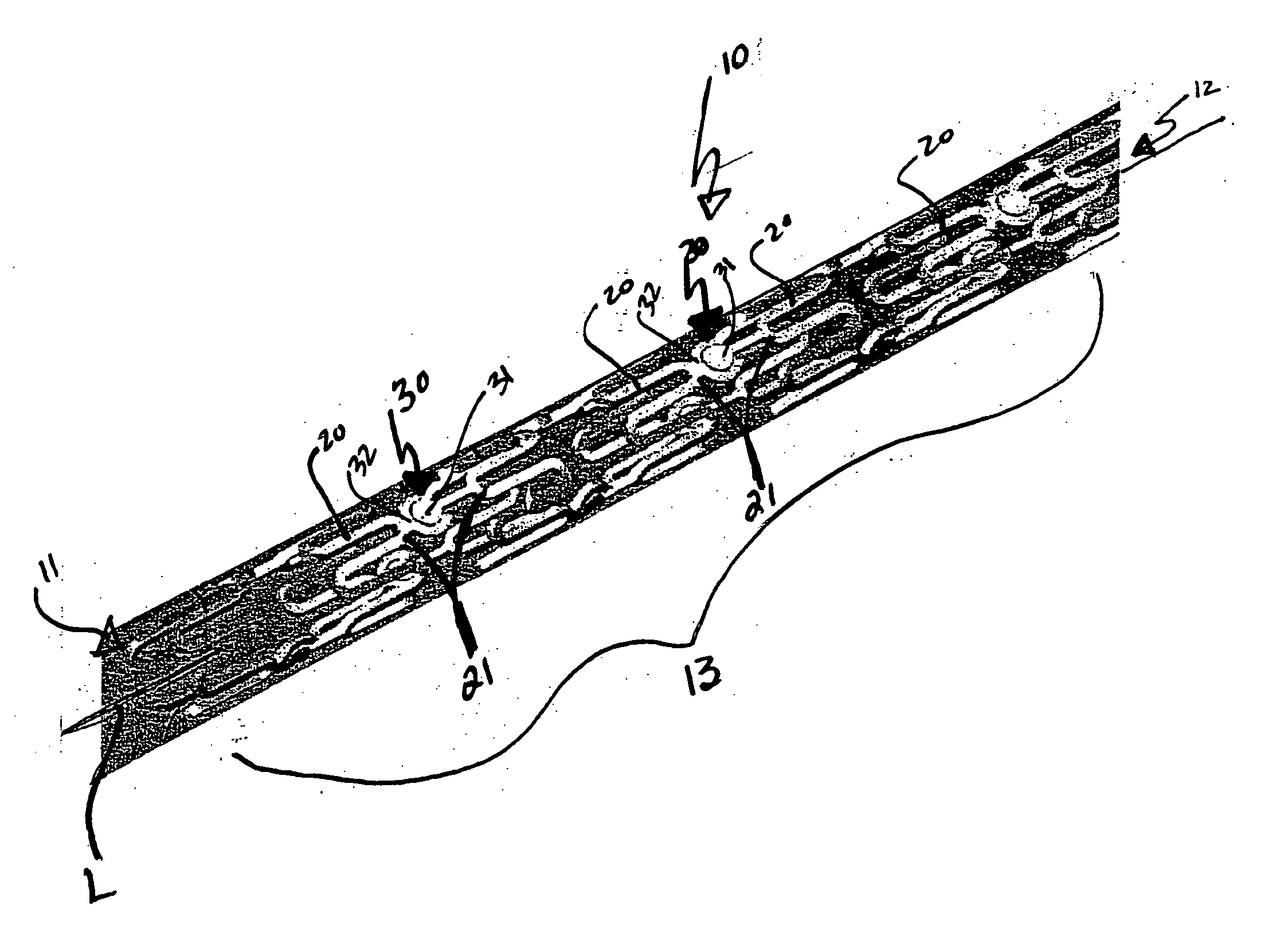 Stent with mechanically interlocking struts and methods for making the same