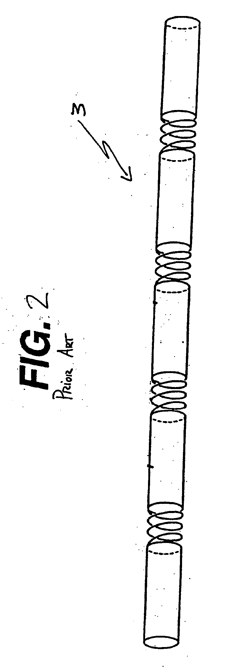 Stent with mechanically interlocking struts and methods for making the same