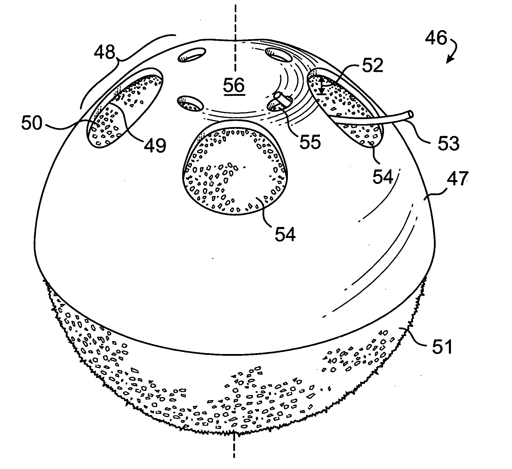 Vaulted perforated coating for orbital implants