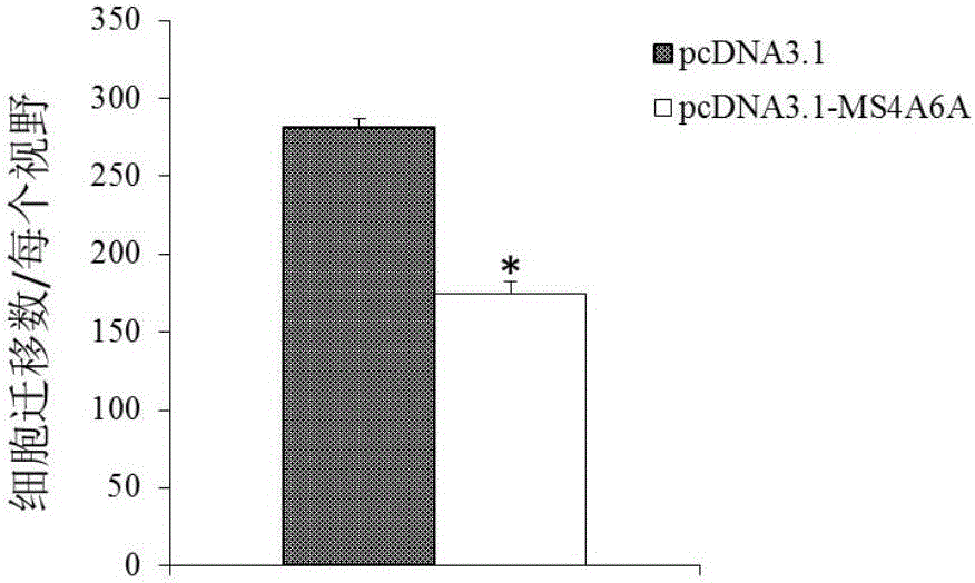 Application of MS4A6A serving as multiple myeloma diagnosis and treatment marker