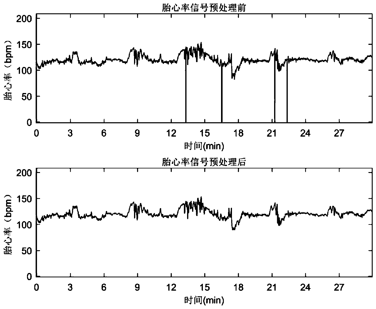 Method and system for measuring and evaluating foetus state based on area of fetal heart rate deceleration zone