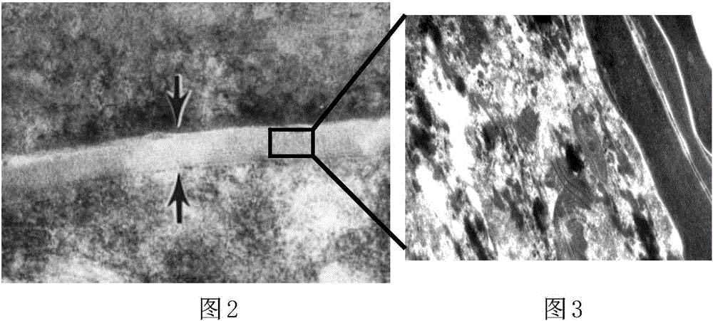 In-vitro recombined human skin epidermis model and preparation method and application thereof