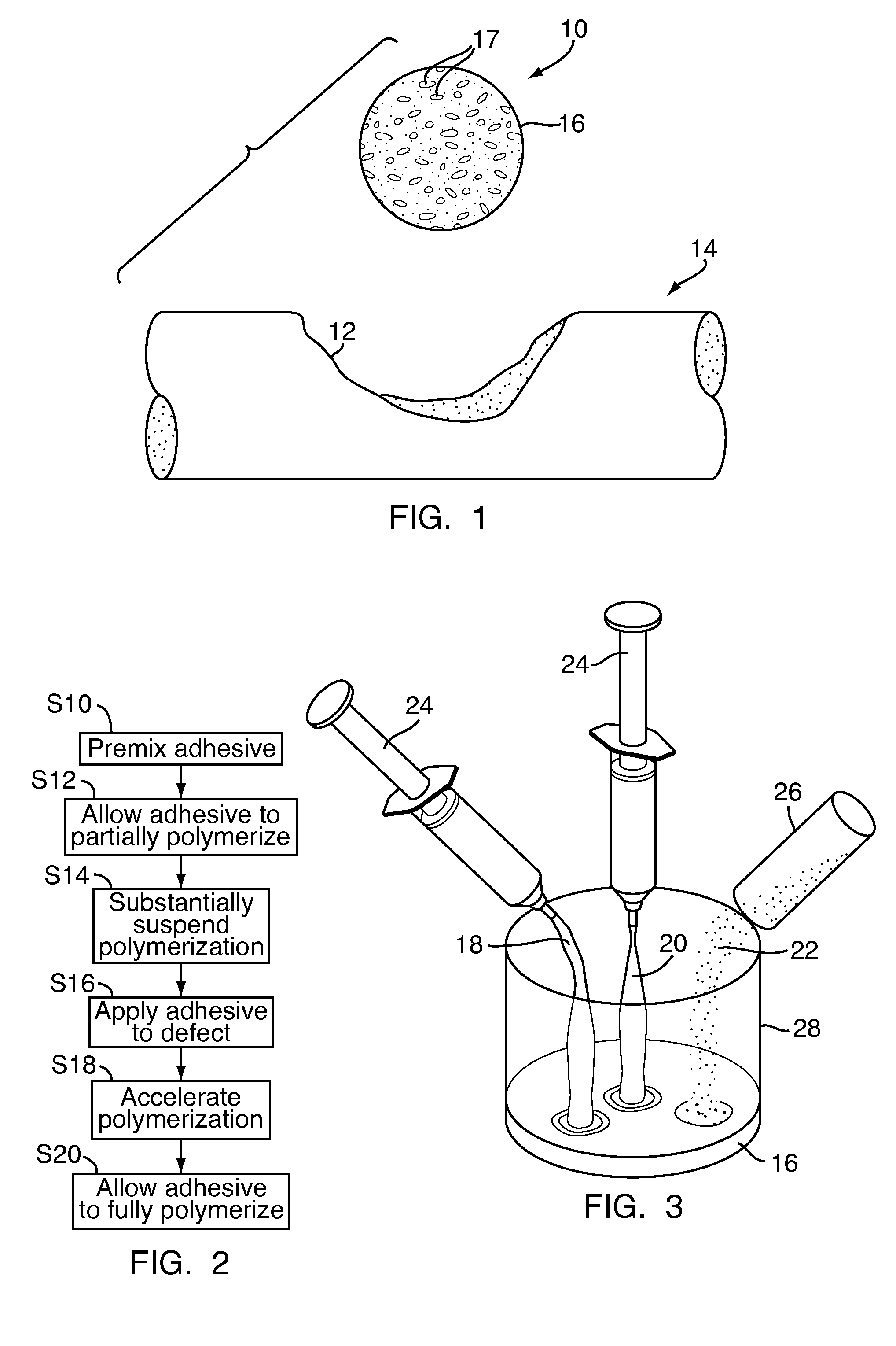 Methods and devices for repairing bone defects