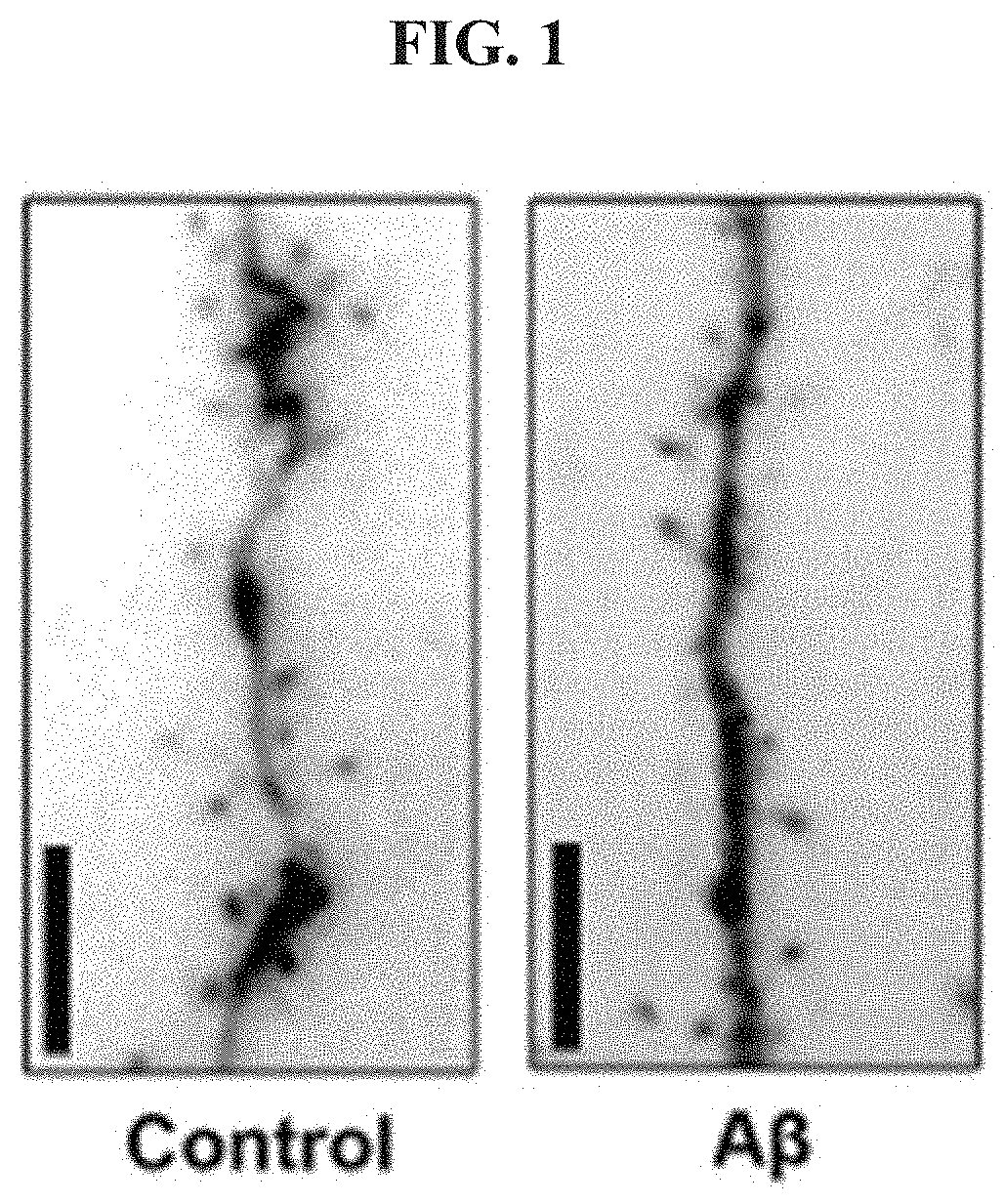 Method of Inducing Dendritic and Synaptic Genesis in Neurodegenerative Chronic Diseases
