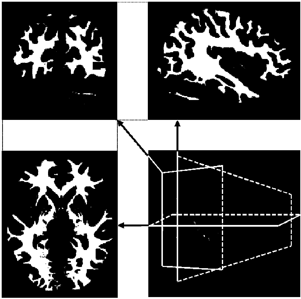 Epilepsy paradoxical discharge locus positioning method and system based on EEG-fMRI