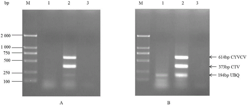 Multi-RT-PCR (reverse transcription-polymerase chain reaction) method for simultaneously detecting citrus yellow vein clearing viruses and citrus tristeza viruses and application of multi-RT-PCR method