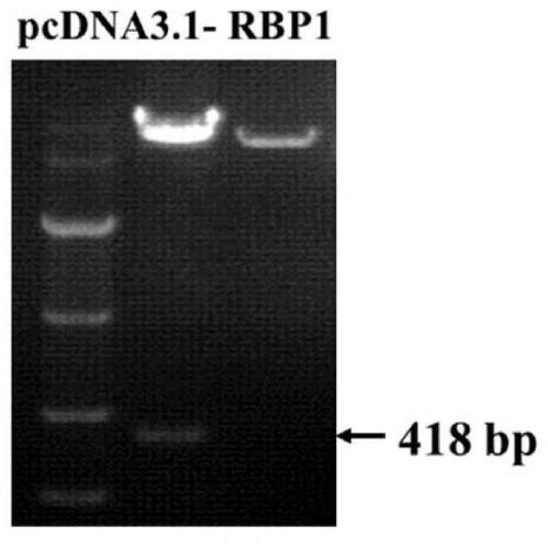 Application of RBP1 gene in sow ovarian granular cells