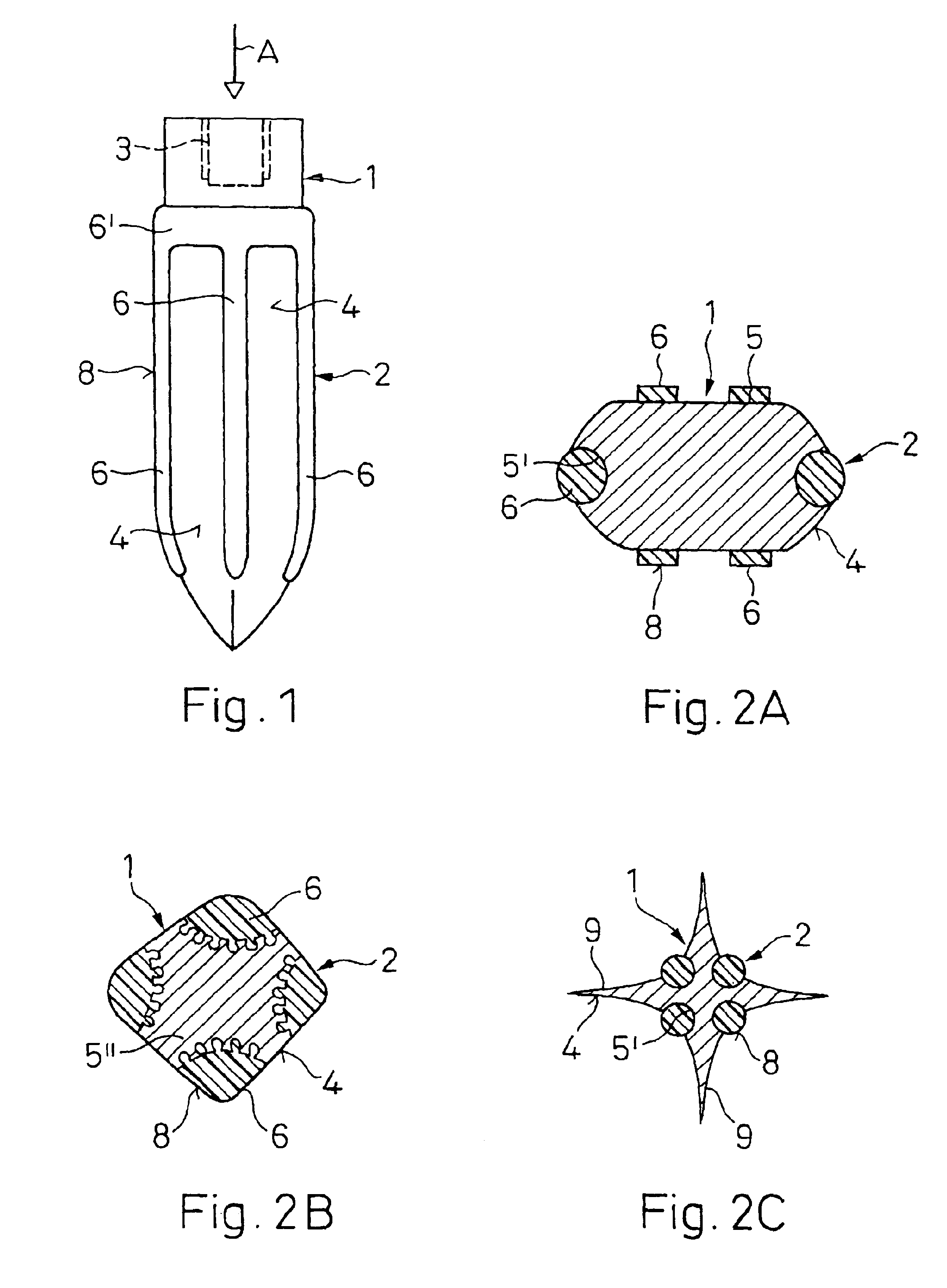 Implant to be implanted in bone tissue or in bone tissue supplemented with bone substitute material