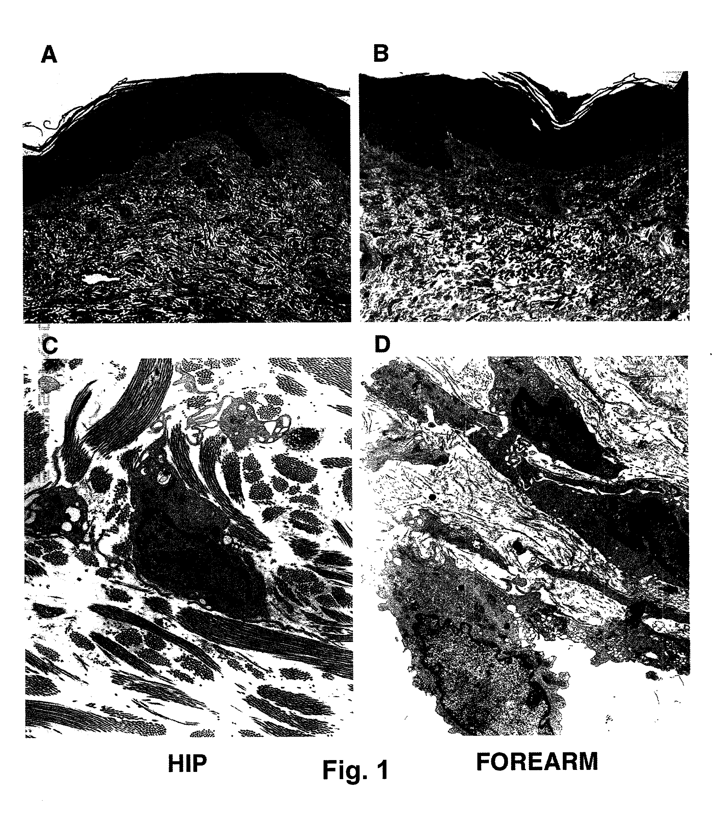 Method for protecting and restoring skin using selective MMP inhibitors