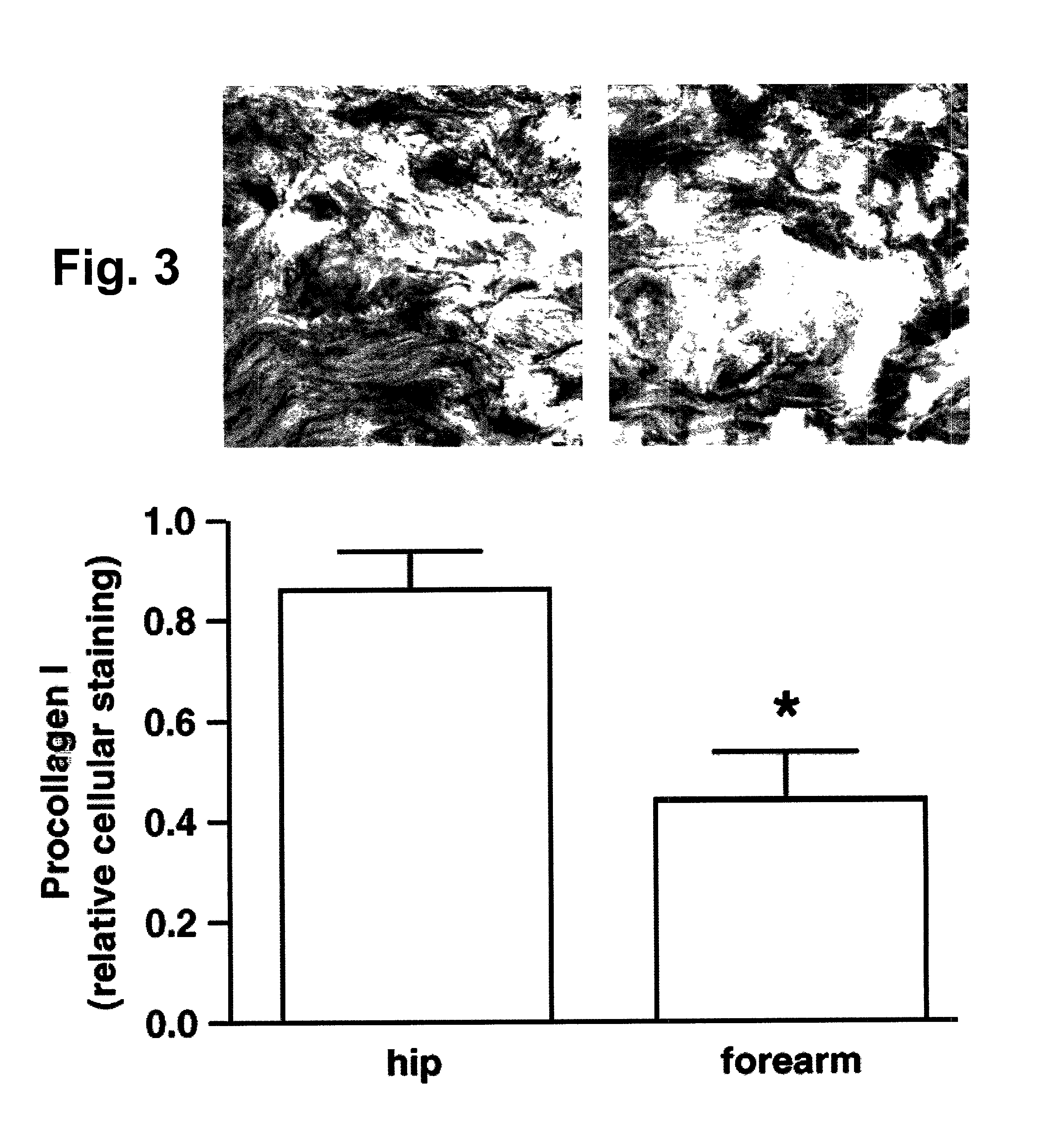 Method for protecting and restoring skin using selective MMP inhibitors