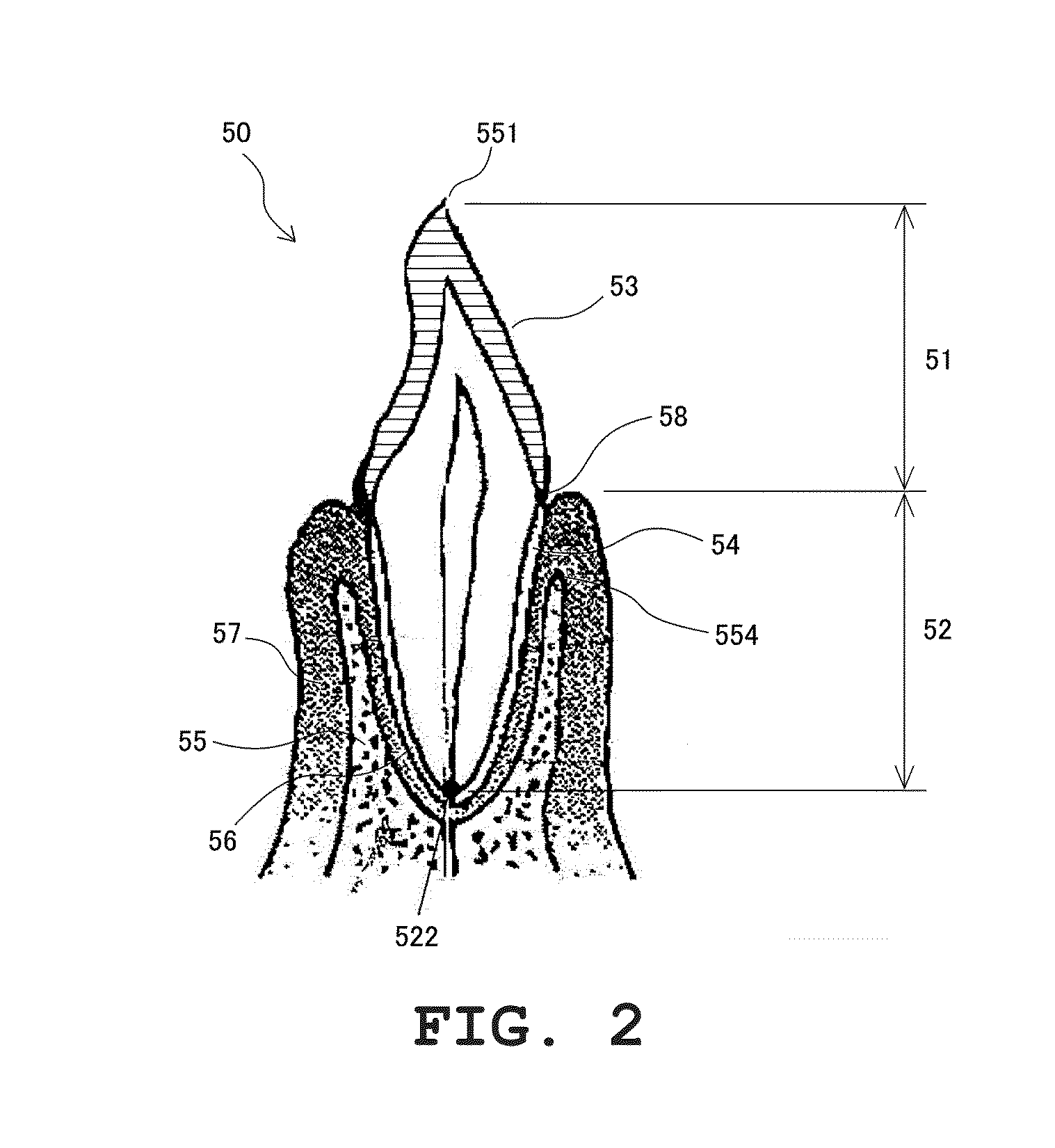 Periodontal disease diagnosis supporting device, periodontal disease diagnosis supporting system, periodontal disease diagnosis supporting program, and periodontal disease diagnosis supporting method
