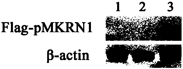 PMKRN1 (porcine Makorin ring finger protein 1) gene-knockout porcine somatic cell, method for preparing same and application of pMKRN1 gene-knockout porcine somatic cell