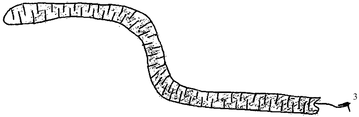 Laser surface treatment method for interventional medical device