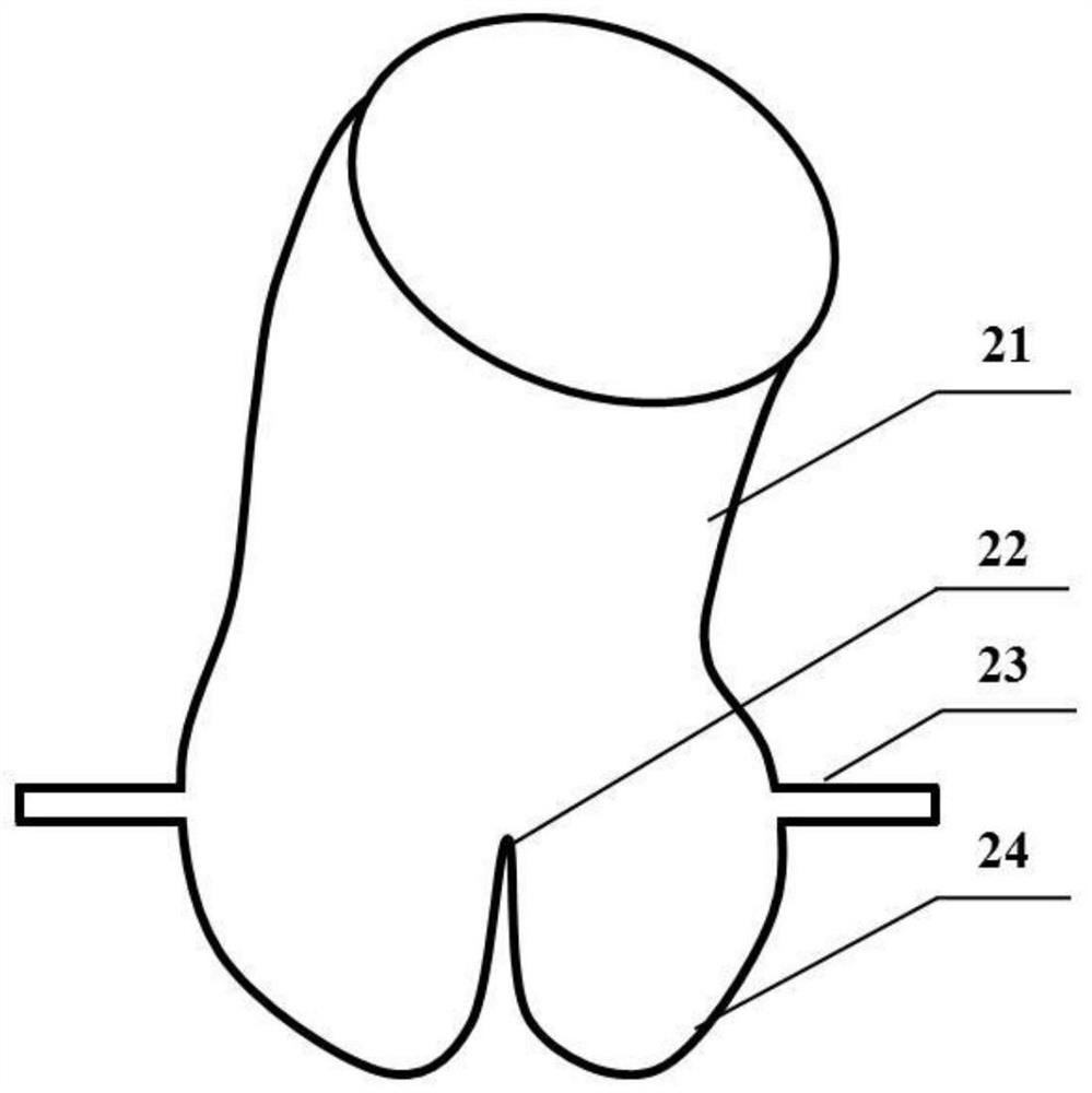 A method for preparing calcified aortic valve based on CT image data