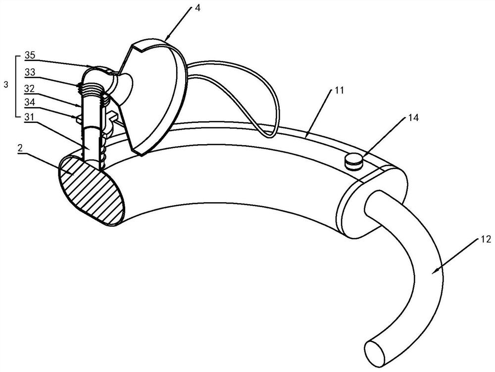 Mask type anti-reverse-suction traditional Chinese medicine aerosol inhalation device