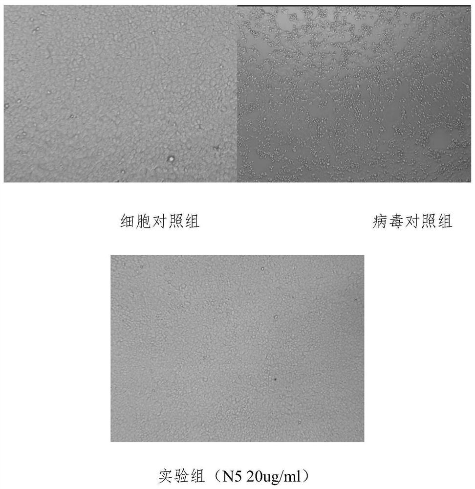 Monoclonal antibody for neutralizing novel coronavirus infection