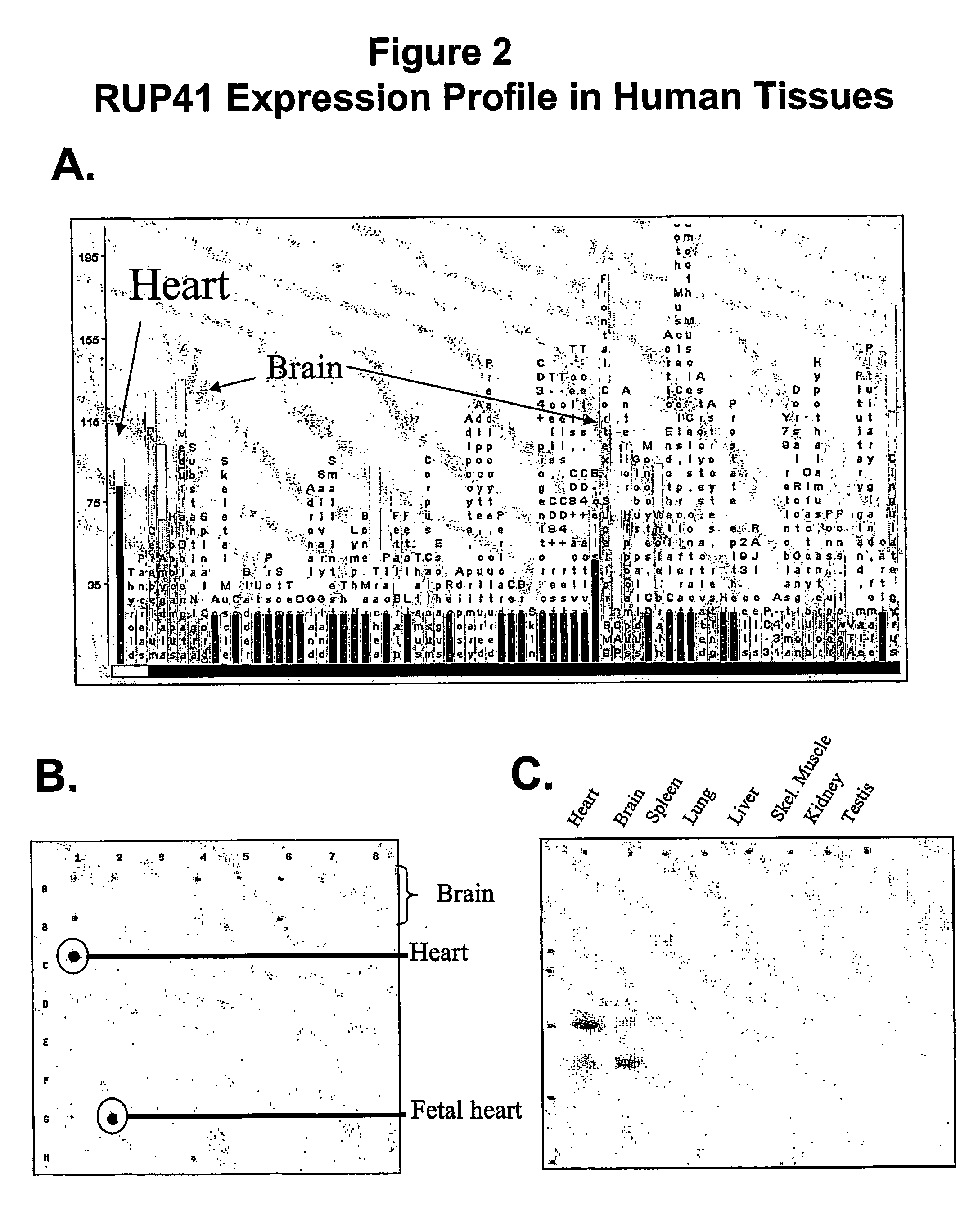 Human g protein-coupled receptor and modulators thereof for the treatment of ischemic heart disease and congestive heart failure