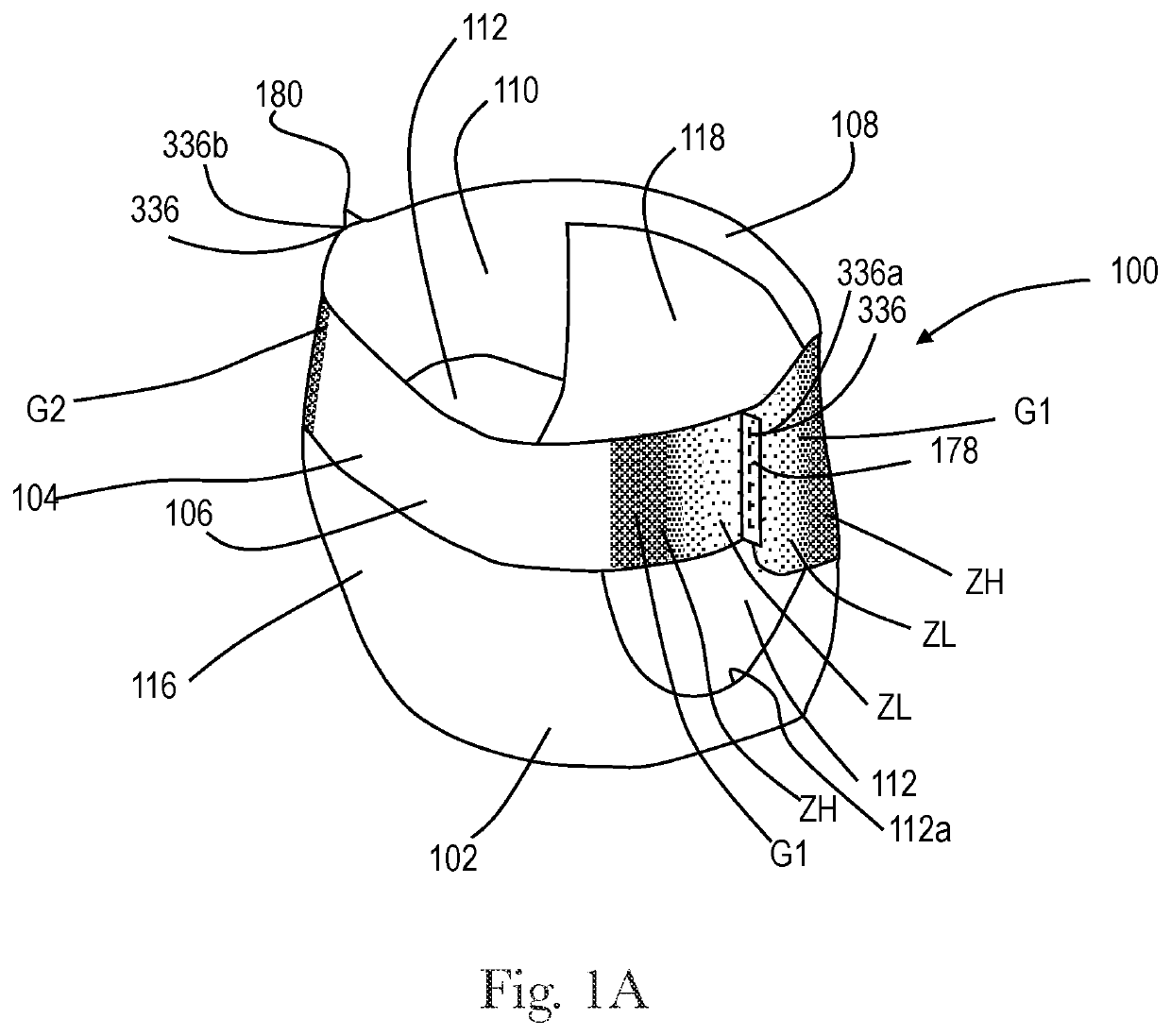 Apparatuses and methods for making absorbent articles with low intensity side seam regions