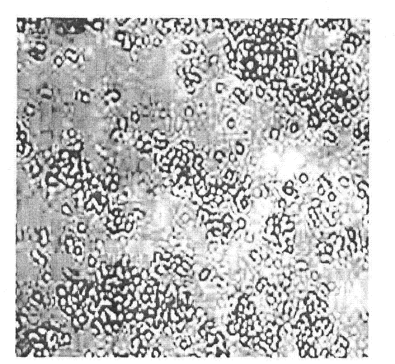 Cis-platinum lung cancer-resistant active targeting concealed liposomes and preparation method thereof