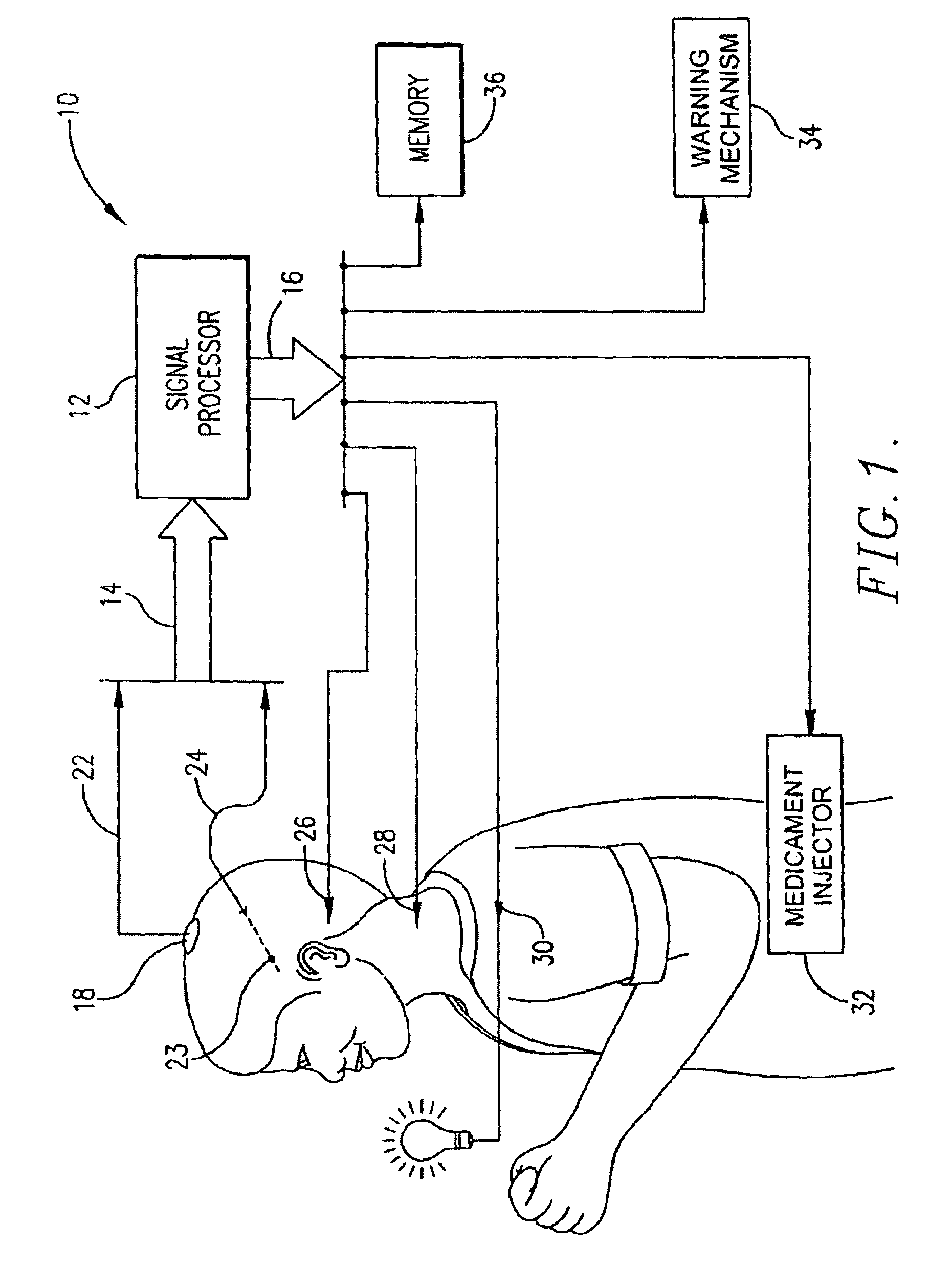 Method and system for the prediction, rapid detection, warning, prevention, or control of changes in the brain states of a subject using hurst parameter estimation