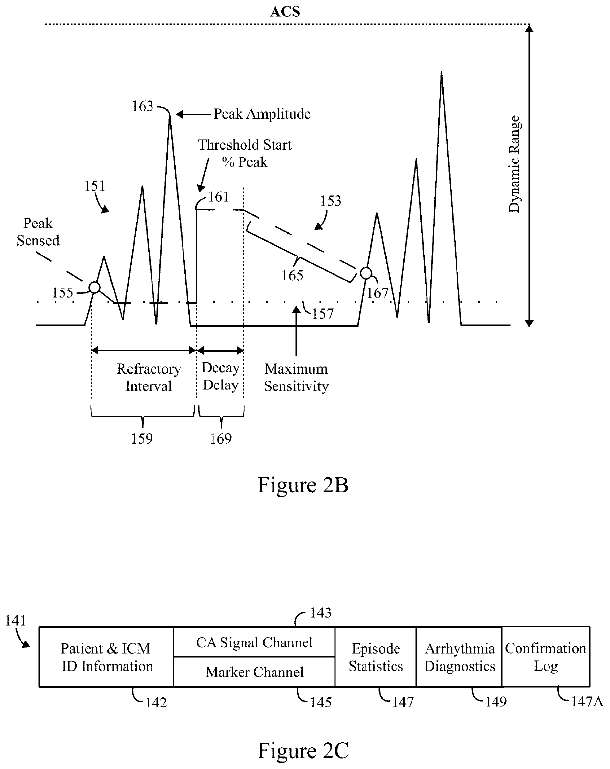 Method and system to detect R-waves in cardiac arrhythmic patterns