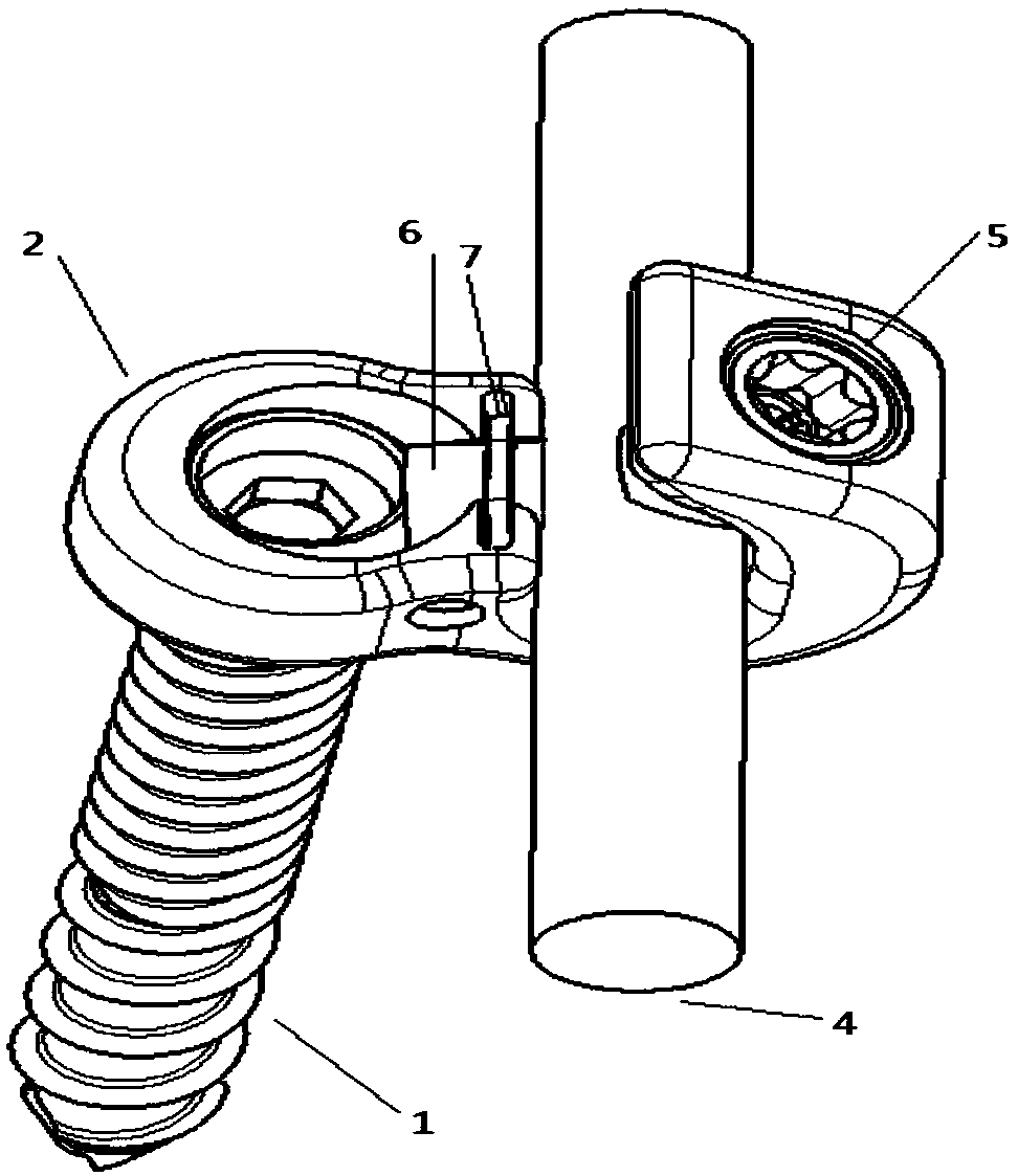 Low-profile easily-locked universal pedicle screw