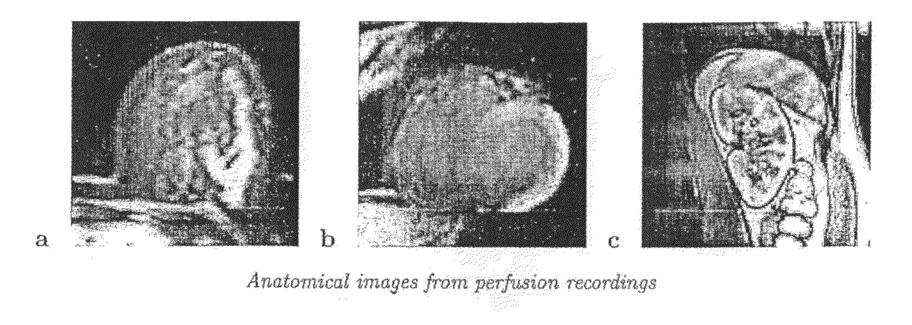 Method of generating an enhanced perfusion image