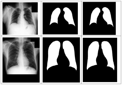 Chest radiography lung field segmentation model establishment based on multi-scale feature fusion and segmentation method