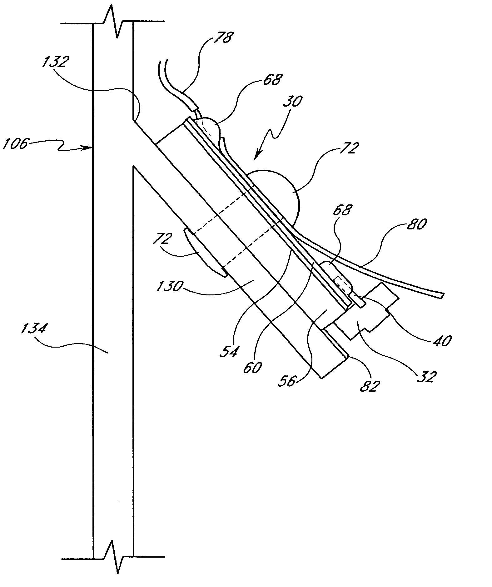 Mounting arrangement for light emitting diodes