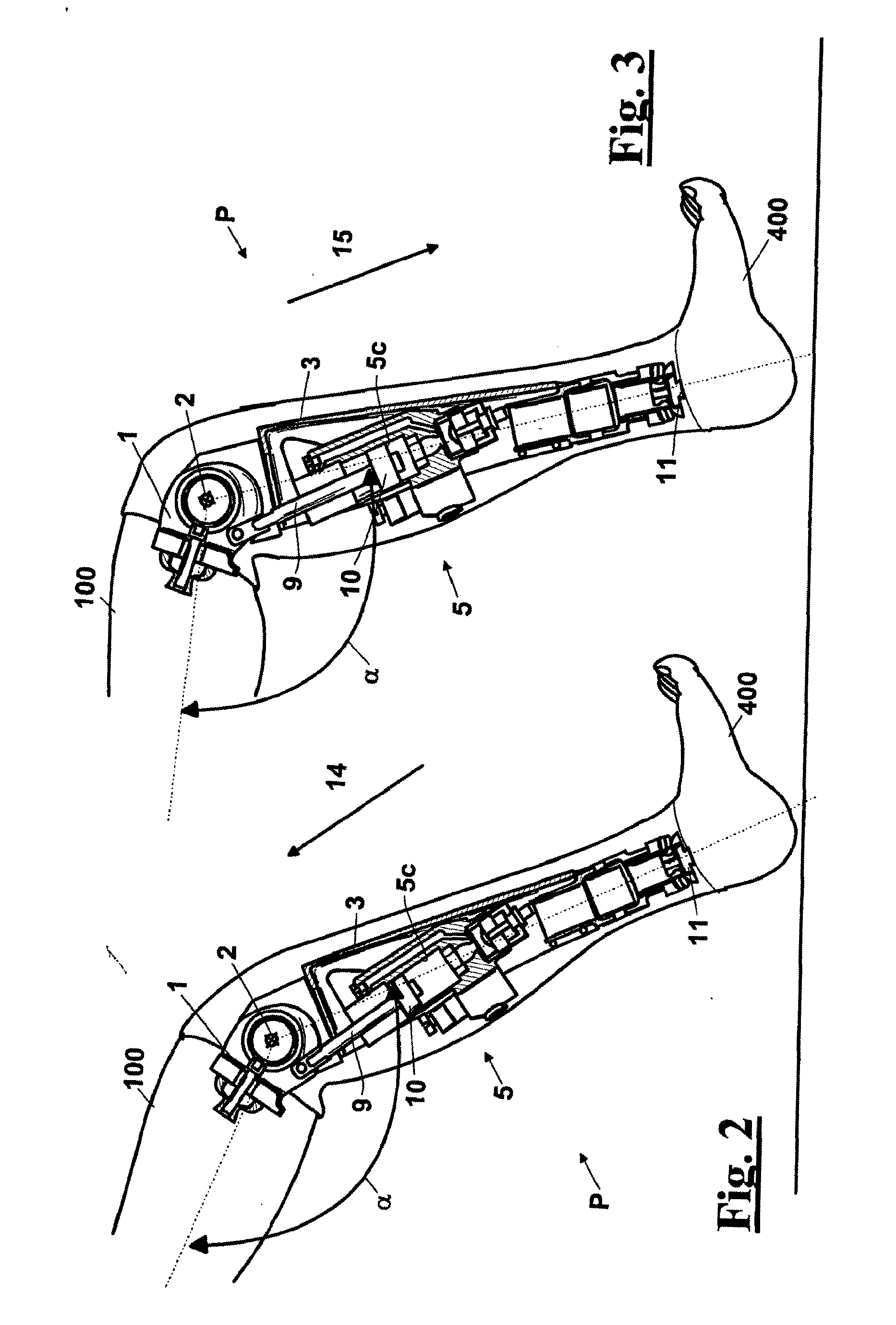 Automatic prosthesis for above-knee amputees