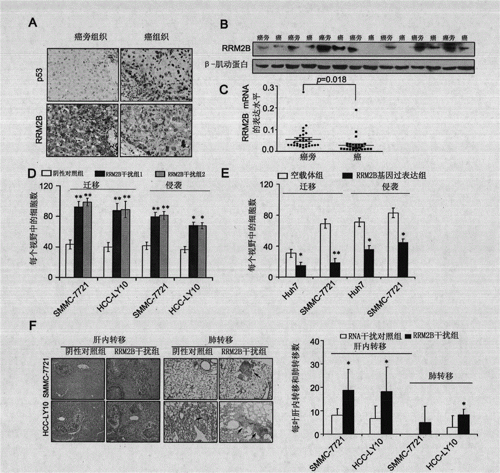 Application of RRM2B gene or protein thereof in metastasis of hepatocellular carcinoma