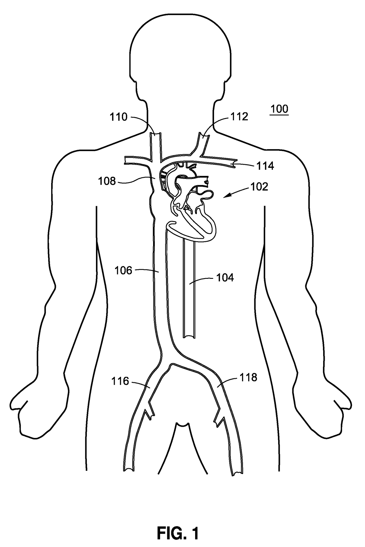 System and method for transcatheter heart valve platform